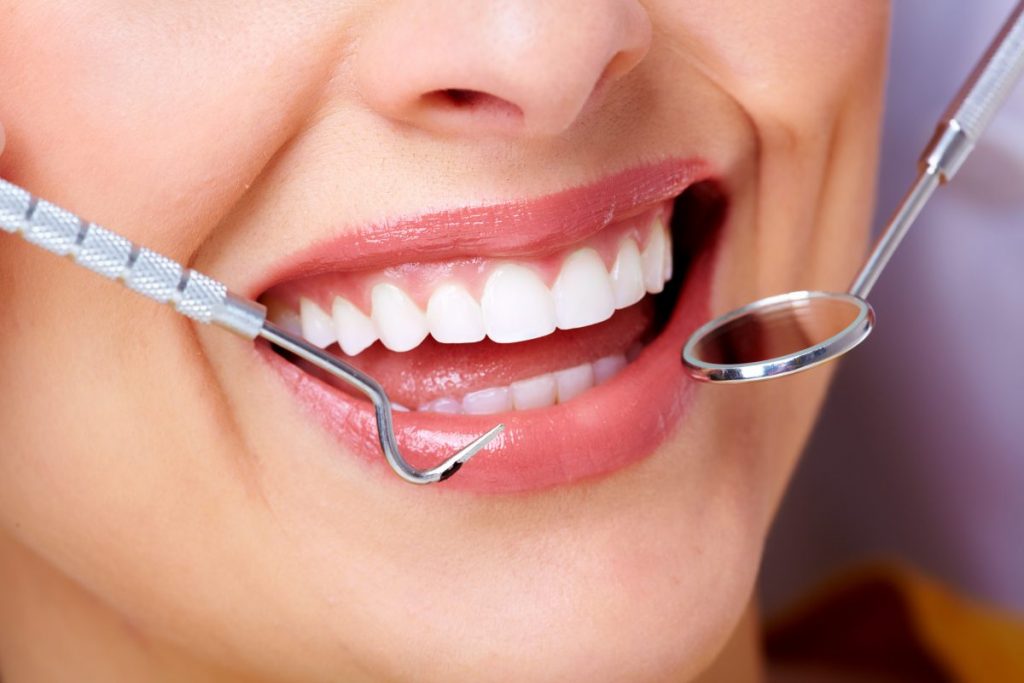 teeth whitening | Dentist Abbotsford