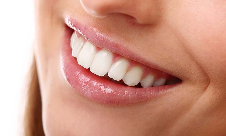 Beautiful Smile with Dental implants