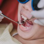 Root Canal Treatment Oral Health